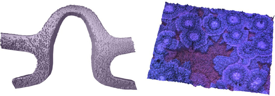 3D topography of cardiac stent and 3D topography of tetraphenylporphyrin (TPP)